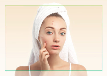 Why does adult acne occur?