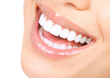 How the LED Natural Teeth Whitening Can Make Your Teeth Shine